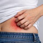 Itching (खुजली) क्या है? इसके लक्षण, कारण और उपाय – पूरी जानकारी