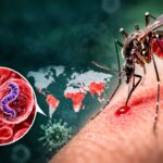 Malaria (मलेरिया) क्या है? कारण, लक्षण और बचाव की पूरी जानकारी