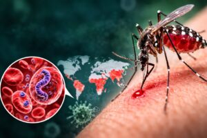 Malaria (मलेरिया) क्या है? कारण, लक्षण और बचाव की पूरी जानकारी