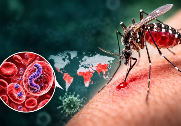 Malaria (मलेरिया) क्या है? कारण, लक्षण और बचाव की पूरी जानकारी